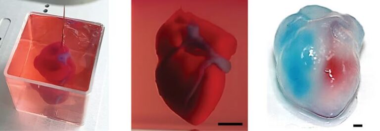 3D nyomtatott szív - a technika állása - 3DNyomtass.hu