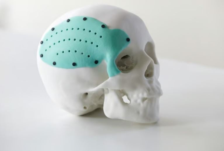 Orvosi 3D nyomtatás: A legjobb egészségügyi alkalmazások - 3DNyomtass.hu